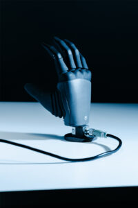 MIA Hand myoelectric prosthesis photographed by Filippo Maffei — image 2 of 11