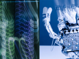 MIA Hand myoelectric prosthesis photographed by Filippo Maffei — image 5 of 11